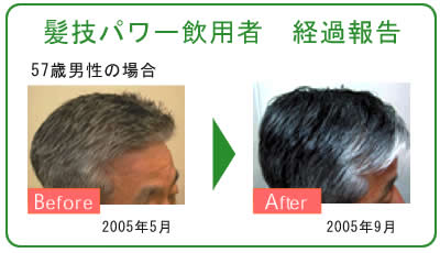 髪技パワー