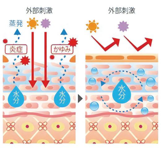 かゆみ・炎症肌