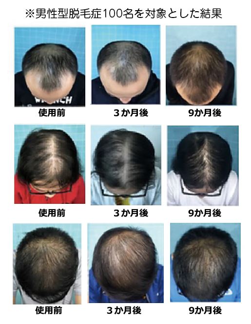 アイ・ヘルメット効果